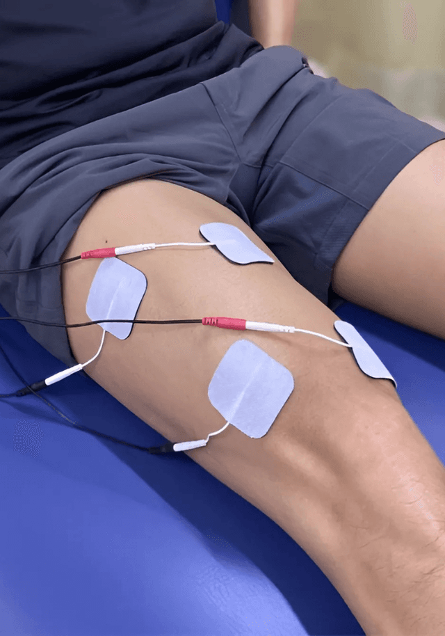 Electrical Stimulation Therapy Treatment